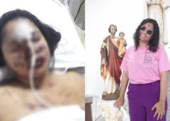 Piauiense perde 95% da visão e descobre síndrome rara após reação alérgica